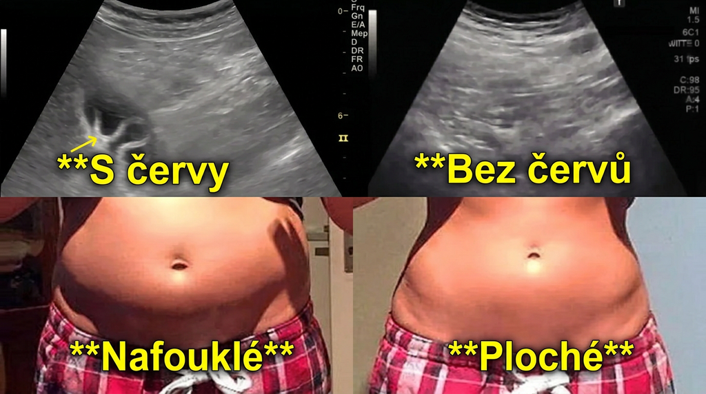 Petra M. - recenzie clientă Belviat